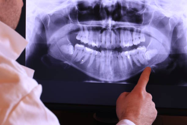 Best Same-Day Emergency Dental Services in Anderson Creek, NC