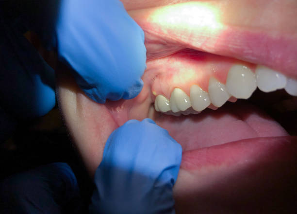 Best 24-Hour Emergency Dentist in Anderson Creek, NC