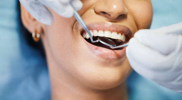 Best Emergency Treatment for Dental Infections or Abscesses in Anderson Creek, NC