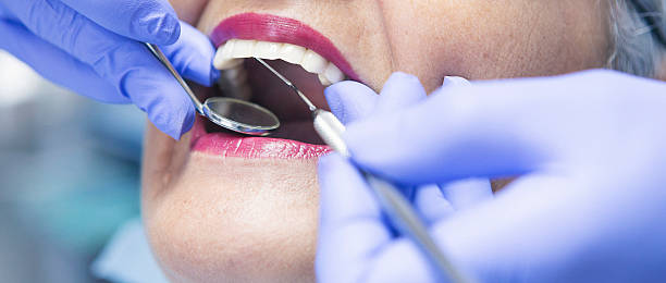 Best Emergency Tooth Extraction in Anderson Creek, NC